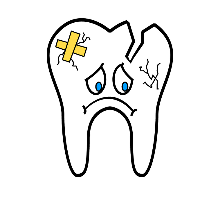 Mckell/Parker Dental advises patients on what to do if their dental crown or filling falls out.